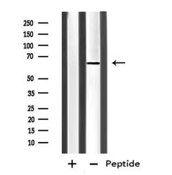 Invitrogen IL4I1 Polyclonal Antibody 100 μL; Unconjugated:Antibodies,