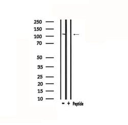 Invitrogen Desmoglein 1 Polyclonal Antibody 100 &mu;L; Unconjugated:Antibodies,