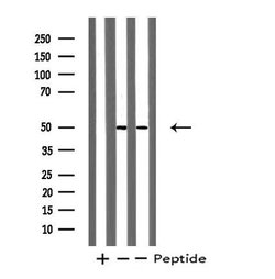 Invitrogen LIM1 Polyclonal Antibody 100 &mu;L; Unconjugated:Antibodies,