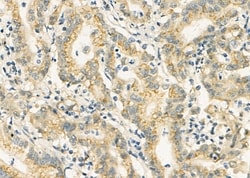 Invitrogen FAM3D Polyclonal Antibody 100 &mu;L; Unconjugated:Antibodies,