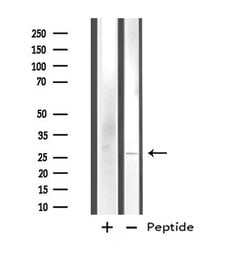 Invitrogen FAM3D Polyclonal Antibody 100 &mu;L; Unconjugated:Antibodies,
