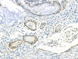 Invitrogen EDG2 Polyclonal Antibody 100 &mu;L; Unconjugated:Antibodies,