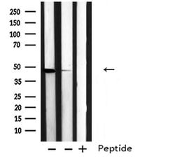 Invitrogen EDG2 Polyclonal Antibody 100 &mu;L; Unconjugated:Antibodies,