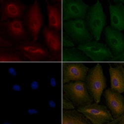 Invitrogen GPR109B Polyclonal Antibody 100 &mu;L; Unconjugated:Antibodies,