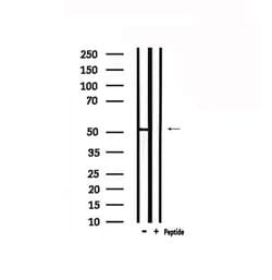 Invitrogen GPR152 Polyclonal Antibody 100 &mu;L; Unconjugated:Antibodies,