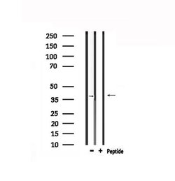 Invitrogen TPRA1 Polyclonal Antibody 100 &mu;L; Unconjugated:Antibodies,