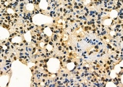 Invitrogen AGTR1 Polyclonal Antibody 100 &mu;L | Buy Online | Invitrogen&trade; | Fisher Scientific