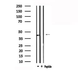 Invitrogen AGTR1 Polyclonal Antibody 100 &mu;L | Buy Online | Invitrogen&trade; | Fisher Scientific