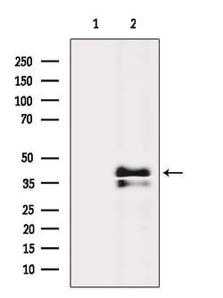 Invitrogen AGTR1 Polyclonal Antibody 100 &mu;L | Buy Online | Invitrogen&trade; | Fisher Scientific