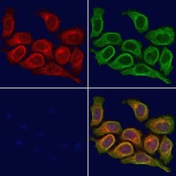 Invitrogen GPR37L1 Polyclonal Antibody 100 μL; Unconjugated:Antibodies,