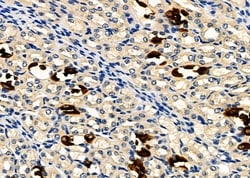 GPR133 Polyclonal Antibody:Antibodies, Polyclonal