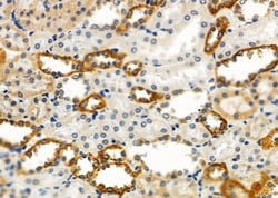 GPR133 Polyclonal Antibody:Antibodies, Polyclonal