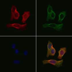 Invitrogen GPR35 Polyclonal Antibody 100 &mu;L | Buy Online | Invitrogen&trade; | Fisher Scientific