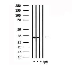 Invitrogen GPR35 Polyclonal Antibody 100 &mu;L | Buy Online | Invitrogen&trade; | Fisher Scientific