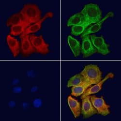 Invitrogen mPR gamma Polyclonal Antibody 100 &mu;L; Unconjugated:Antibodies,