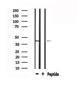 Invitrogen mPR gamma Polyclonal Antibody 100 &mu;L; Unconjugated:Antibodies,
