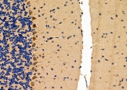 NPY1R Polyclonal Antibody:Antibodies, Polyclonal