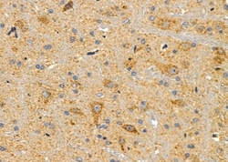 NPY1R Polyclonal Antibody:Antibodies, Polyclonal