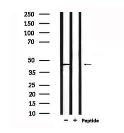 NPY1R Polyclonal Antibody:Antibodies, Polyclonal