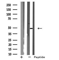 NPY1R Polyclonal Antibody:Antibodies, Polyclonal