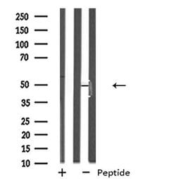 Invitrogen NPY5R Polyclonal Antibody 100 &mu;L; Unconjugated:Antibodies,