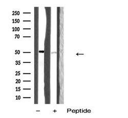 Invitrogen QRFPR Polyclonal Antibody 100 &mu;L; Unconjugated:Antibodies,