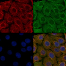 Invitrogen SCTR Polyclonal Antibody 100 &mu;L; Unconjugated:Antibodies,