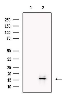 Invitrogen IL-17A Polyclonal Antibody 100 &mu;L; Unconjugated:Antibodies,