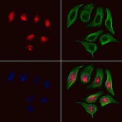 Invitrogen ARNT Polyclonal Antibody 100 μL; Unconjugated:Antibodies,