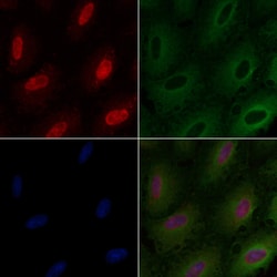 Invitrogen ARNT Polyclonal Antibody 100 μL; Unconjugated:Antibodies,