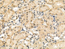 Invitrogen ARNT Polyclonal Antibody 100 μL; Unconjugated:Antibodies,