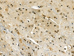 Invitrogen ARNT Polyclonal Antibody 100 μL; Unconjugated:Antibodies,