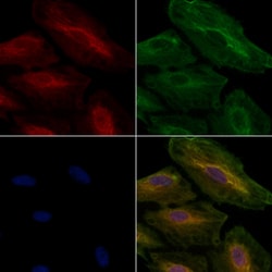 Invitrogen RAP1A Polyclonal Antibody 100 μL; Unconjugated:Antibodies,