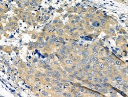 Invitrogen RAP1A Polyclonal Antibody 100 μL; Unconjugated:Antibodies,