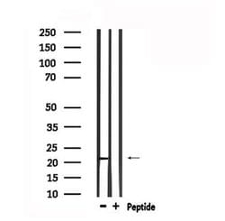 Invitrogen RAP1A Polyclonal Antibody 100 μL; Unconjugated:Antibodies,