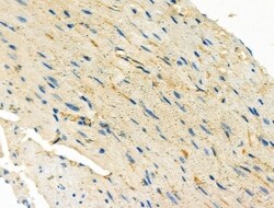 Invitrogen Endothelin 3 Polyclonal Antibody 100 &mu;L; Unconjugated:Antibodies,