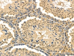 Invitrogen Endothelin 3 Polyclonal Antibody 100 &mu;L; Unconjugated:Antibodies,