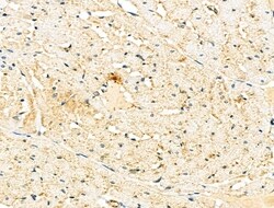 Invitrogen Endothelin 3 Polyclonal Antibody 100 &mu;L; Unconjugated:Antibodies,