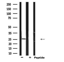 Invitrogen Endothelin 3 Polyclonal Antibody 100 &mu;L; Unconjugated:Antibodies,