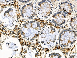 MTAP Polyclonal Antibody:Antibodies, Polyclonal