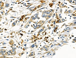 MTAP Polyclonal Antibody:Antibodies, Polyclonal