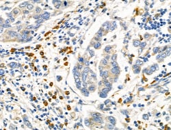 MTAP Polyclonal Antibody:Antibodies, Polyclonal