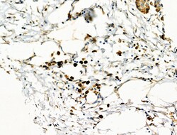 MTAP Polyclonal Antibody:Antibodies, Polyclonal