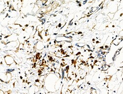 MTAP Polyclonal Antibody:Antibodies, Polyclonal