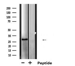 MTAP Polyclonal Antibody:Antibodies, Polyclonal