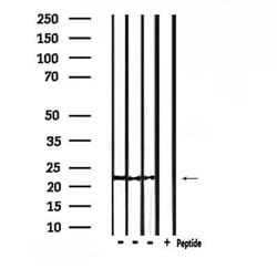 Invitrogen Rho Pan Polyclonal Antibody 100 &mu;L; Unconjugated:Antibodies,