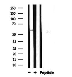 Invitrogen ALPL Polyclonal Antibody 100 &mu;L; Unconjugated:Antibodies,