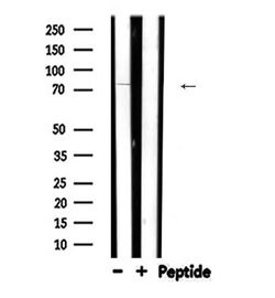 ARHGEF7 Polyclonal Antibody:Antibodies, Polyclonal