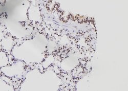 Invitrogen E2F8 Polyclonal Antibody 100 &mu;L | Buy Online | Invitrogen&trade; | Fisher Scientific