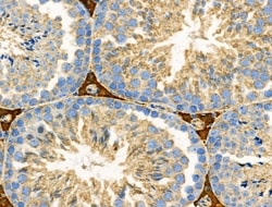 Invitrogen RALBP1 Polyclonal Antibody 100 &mu;L; Unconjugated:Antibodies,